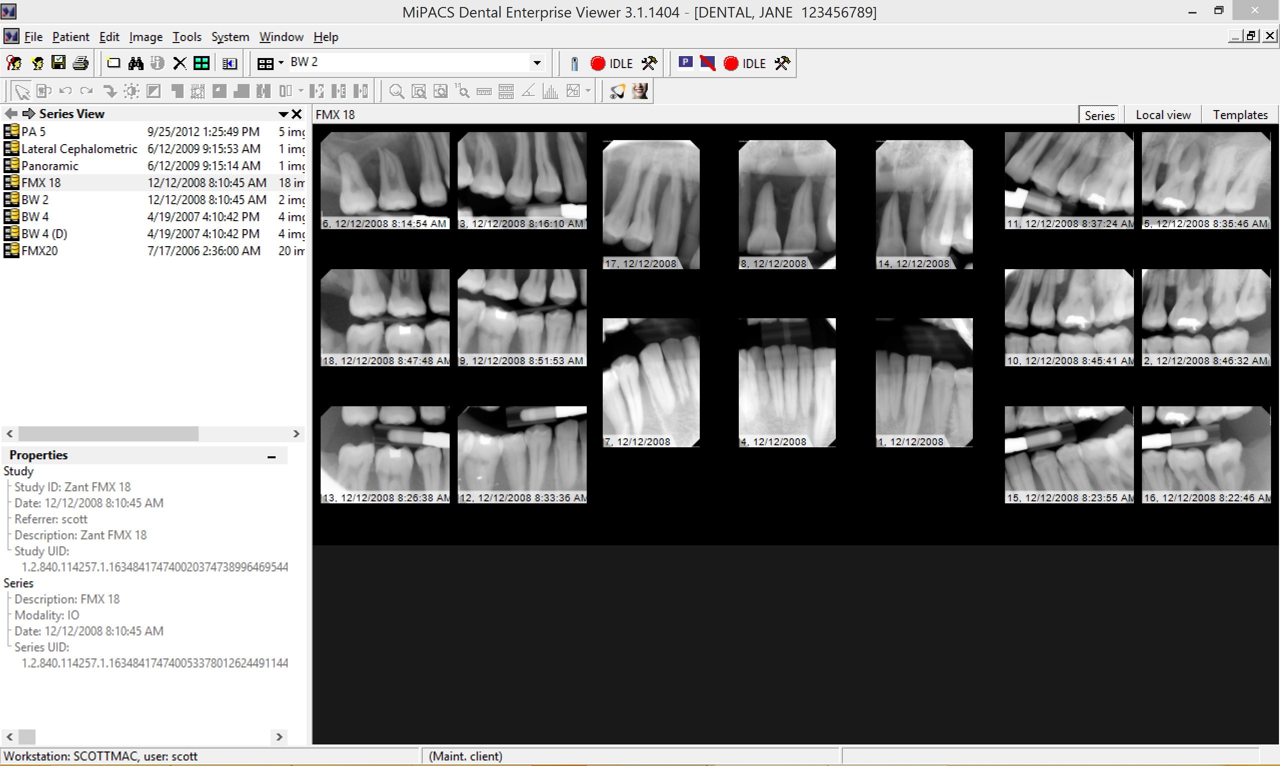 invivo dental viewer download cnet